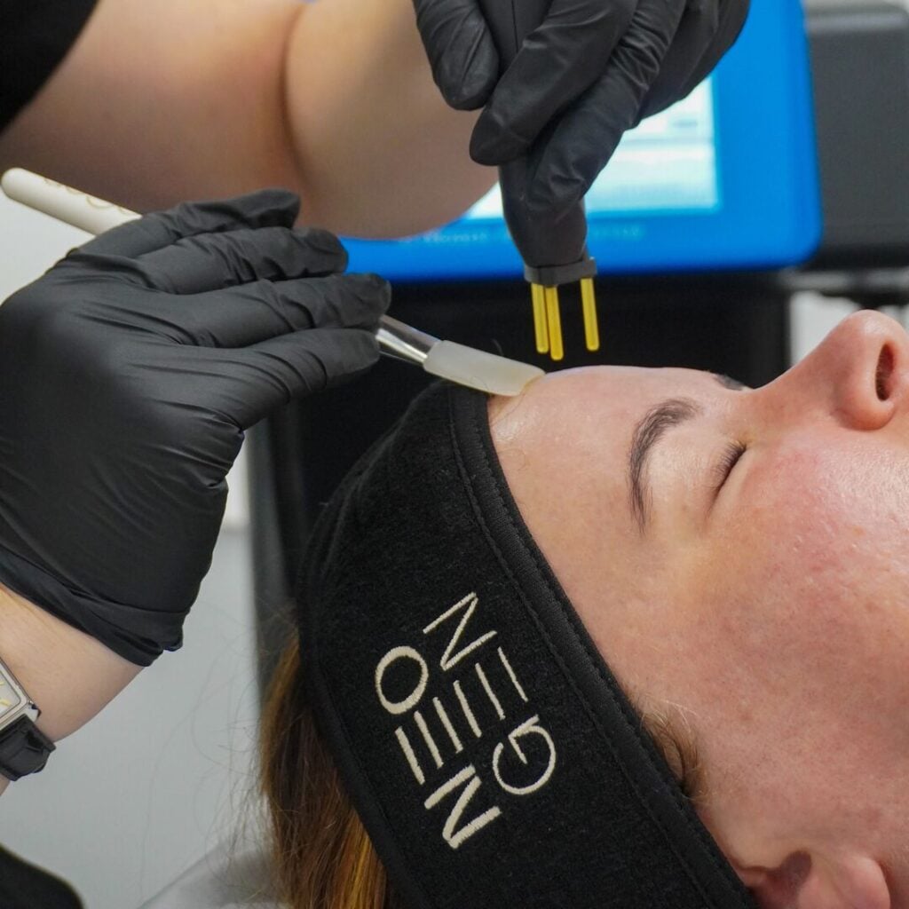 NeoGen plasma skin treatment at Fox Collective, Hitchin