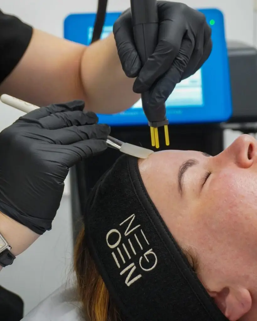 Practitioner performing NeoGen nitrogen plasma skin regeneration treatment on a patient’s forehead